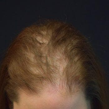 Vorher Frauen Bild 1