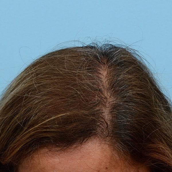 Nachher Frauen Bild 1
